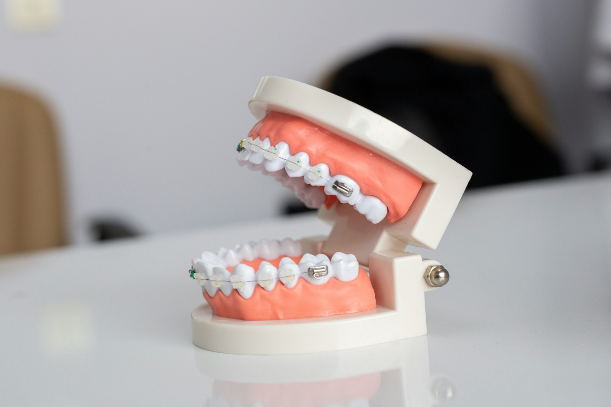 SEO service offer in Quebec for Orthodontics