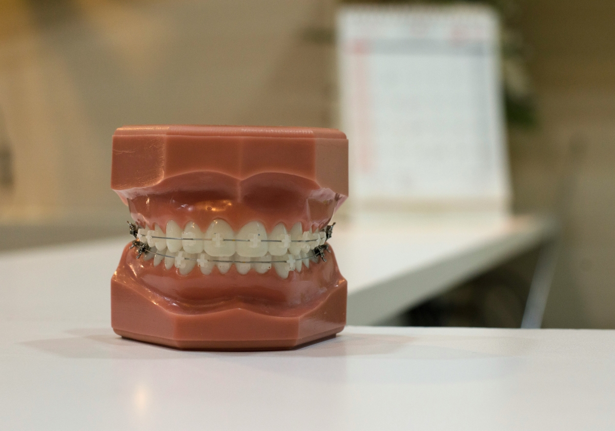 Offre de service SEO au Québec pour l'orthodontie
