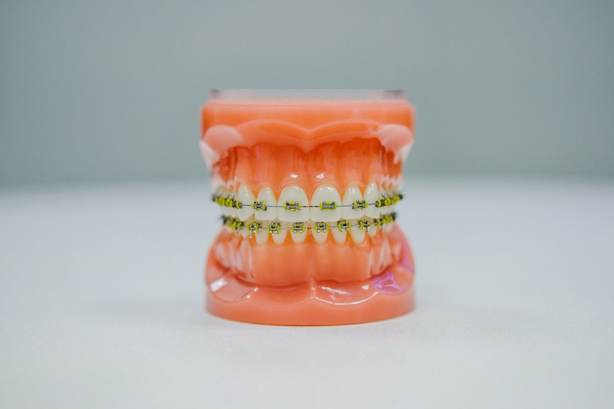 What are orthodontic retainers ?