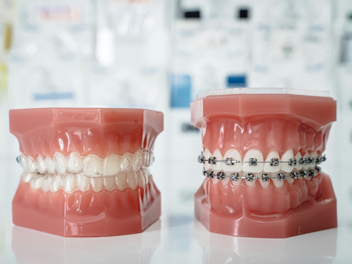 Orthodontist free consultation near me