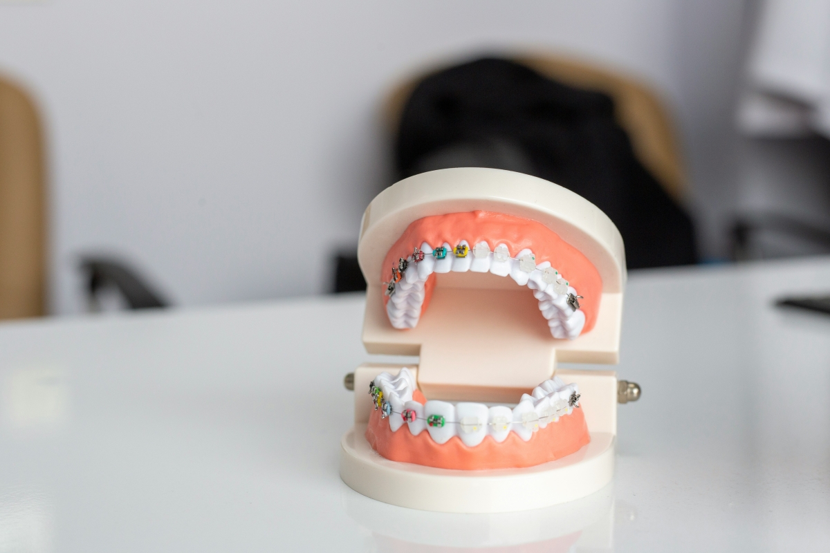 Offrir du SEO au Québec pour les Orthodontistes!